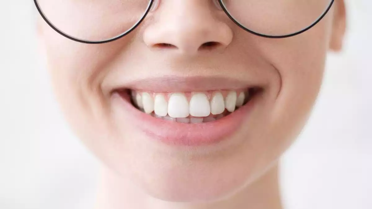 A woman showing her teeth